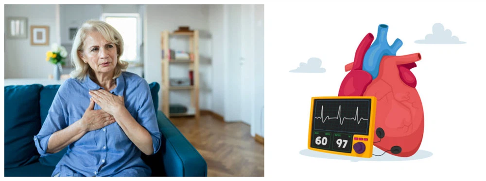 Cardiovascular System Cardiovascular System